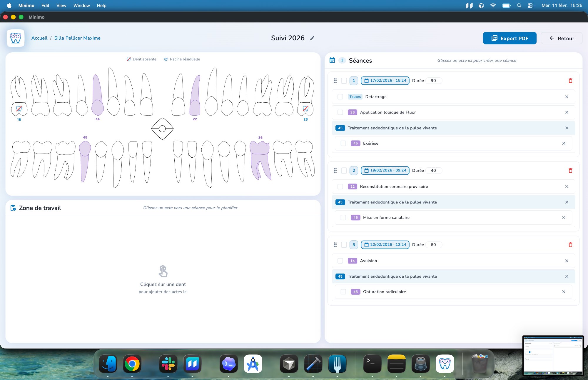 Plan de traitement Minimo
